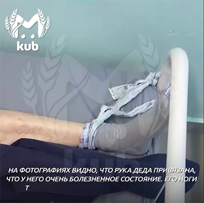 Нога пожилого пациента, привязанная к кровати. Кадр из видео https://t.me/live_kuban/108118